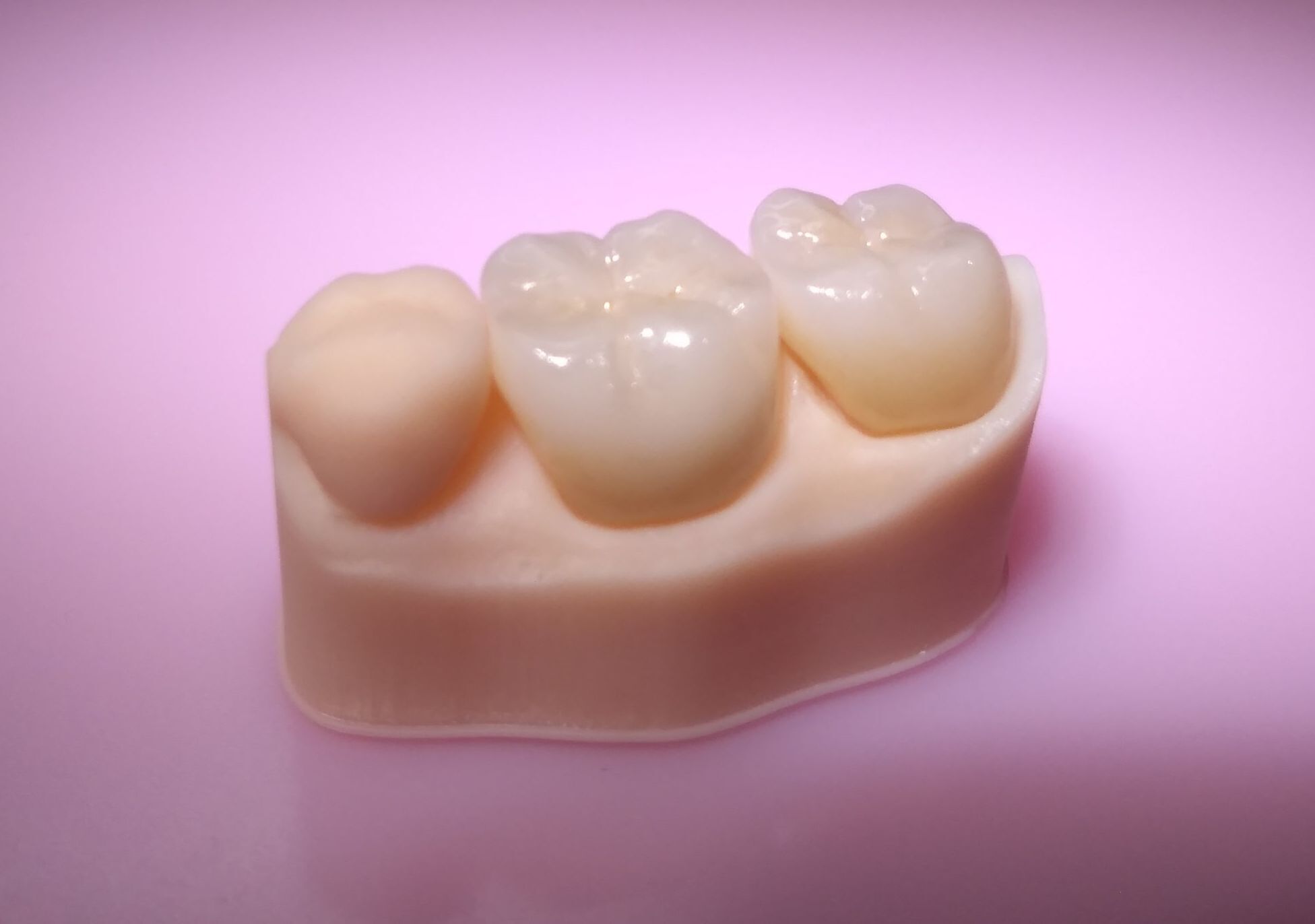 医院通信 クロスガーデンデンタルクリニック 東京都多摩センター 医院通信 クロスガーデンデンタルクリニック 東京都多摩センター